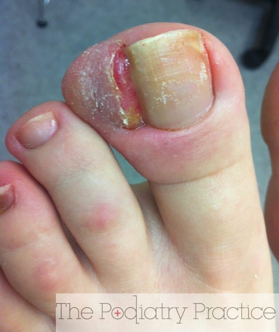 Photo of Mrs. Pointer Toe