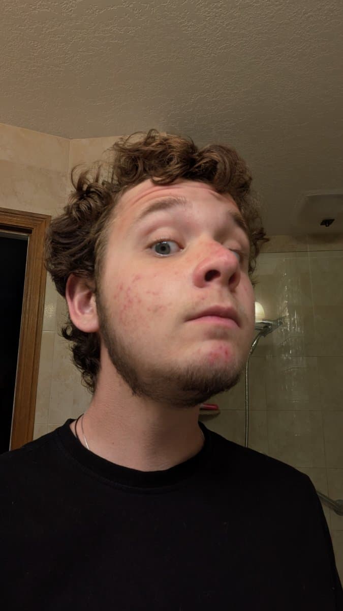Photo of Mason's Neck Beard
